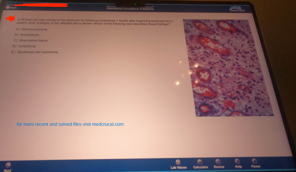 IFOM 2024 Exam Recalls Latest Questions, Study Materials, and