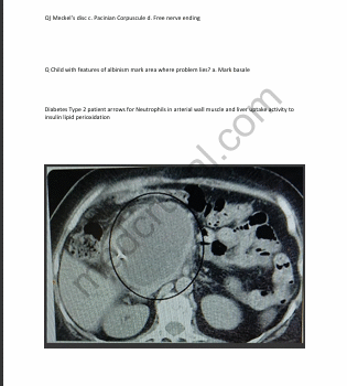 June 2025 USMLE Step 1 Recalls Questions & Answers | Solved Recall Bundle